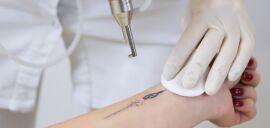Акція на Лазерне видалення татуажу брів в Natalimage від Pokupon